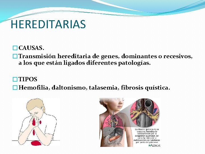HEREDITARIAS �CAUSAS. �Transmisión hereditaria de genes, dominantes o recesivos, a los que están ligados HEREDITARIAS �CAUSAS. �Transmisión hereditaria de genes, dominantes o recesivos, a los que están ligados