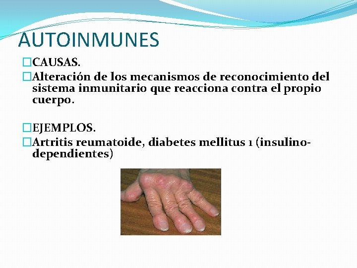AUTOINMUNES �CAUSAS. �Alteración de los mecanismos de reconocimiento del sistema inmunitario que reacciona contra AUTOINMUNES �CAUSAS. �Alteración de los mecanismos de reconocimiento del sistema inmunitario que reacciona contra
