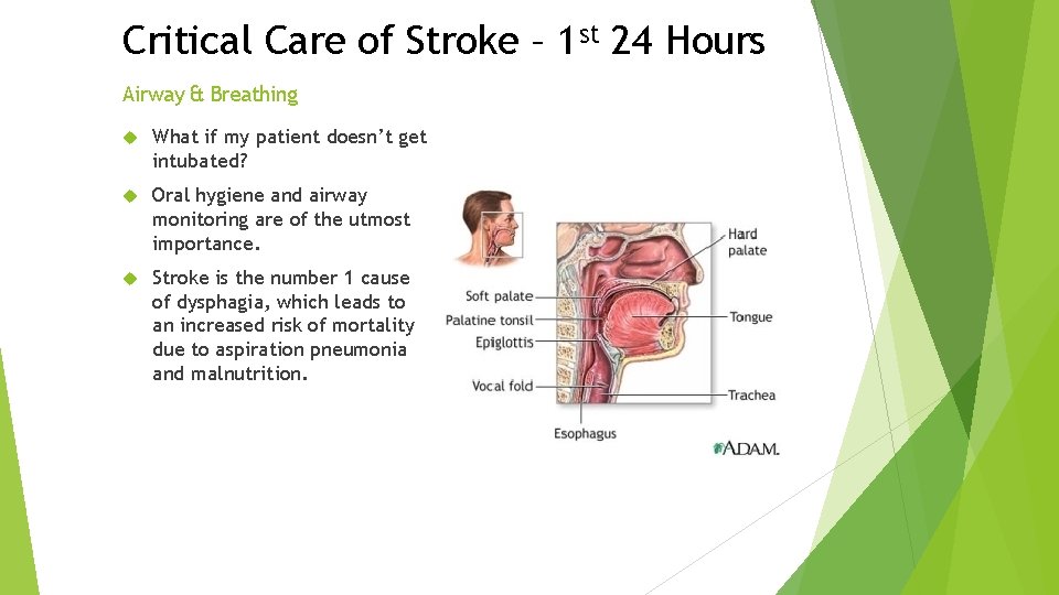 Critical Care of Stroke – 1 st 24 Hours Airway & Breathing What if Critical Care of Stroke – 1 st 24 Hours Airway & Breathing What if