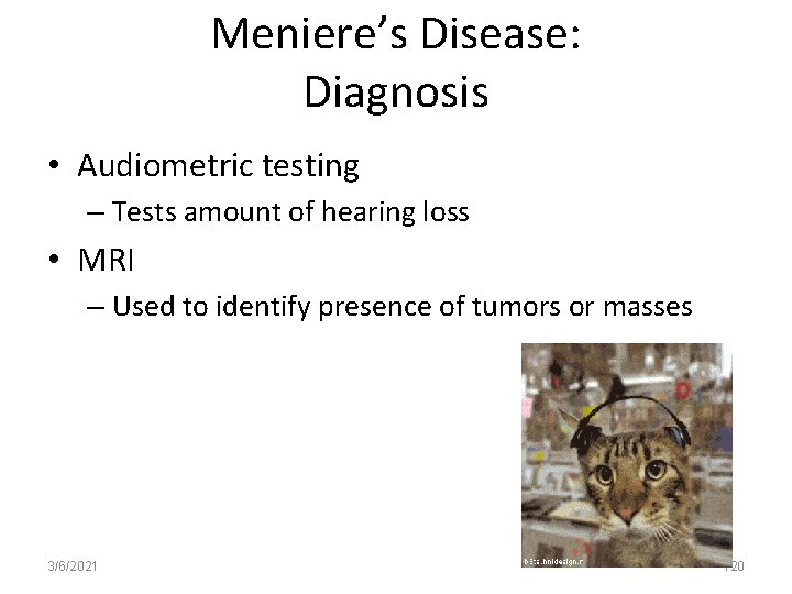Meniere’s Disease: Diagnosis • Audiometric testing – Tests amount of hearing loss • MRI