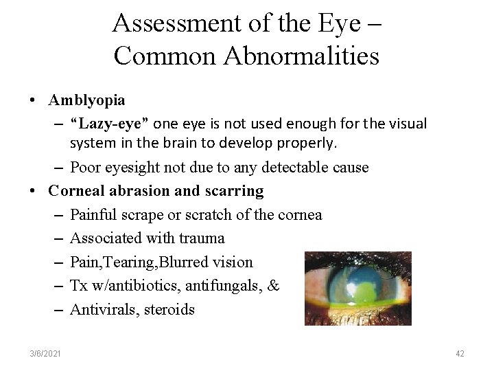 Assessment of the Eye – Common Abnormalities • Amblyopia – “Lazy-eye” one eye is