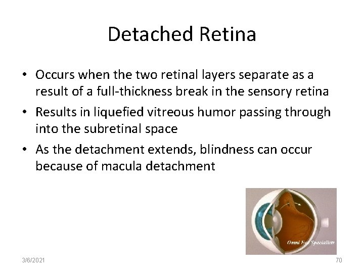 Detached Retina • Occurs when the two retinal layers separate as a result of