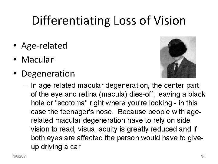 Differentiating Loss of Vision • Age-related • Macular • Degeneration – In age-related macular