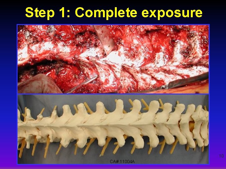 Step 1: Complete exposure 10 CA# 11004 A 