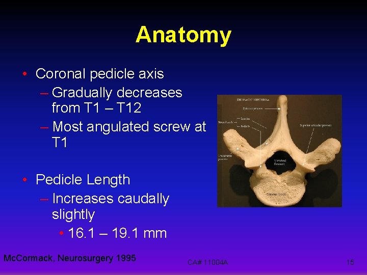 Anatomy • Coronal pedicle axis – Gradually decreases from T 1 – T 12