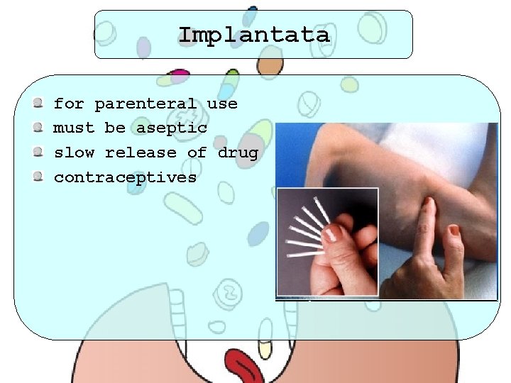 Implantata for parenteral use must be aseptic slow release of drug contraceptives 