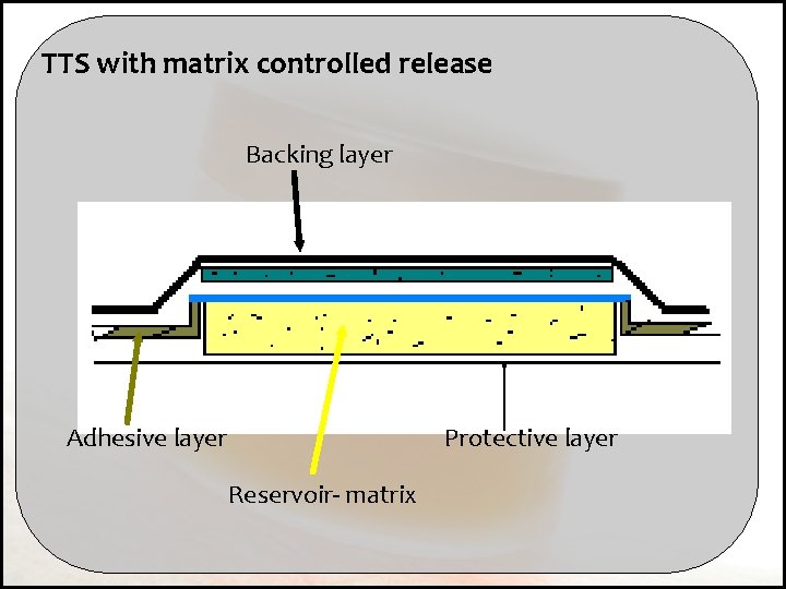 TTS with matrix controlled release Backing layer Adhesive layer Protective layer Reservoir- matrix 