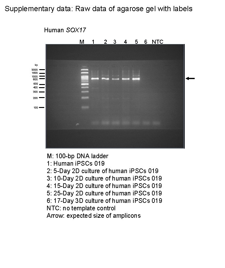Supplementary data: Raw data of agarose gel with labels Human SOX 17 M 1