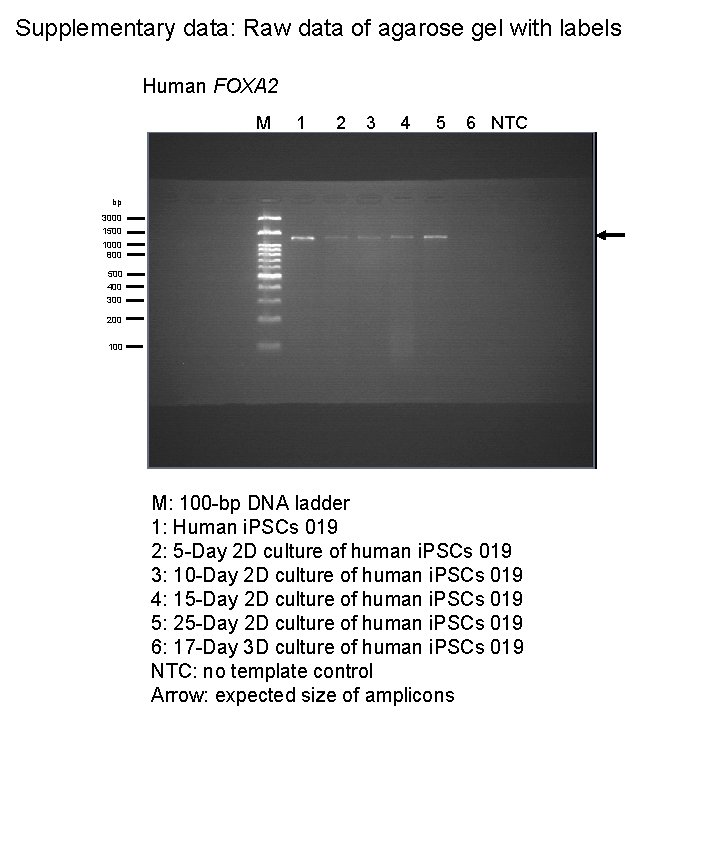 Supplementary data: Raw data of agarose gel with labels Human FOXA 2 M 1