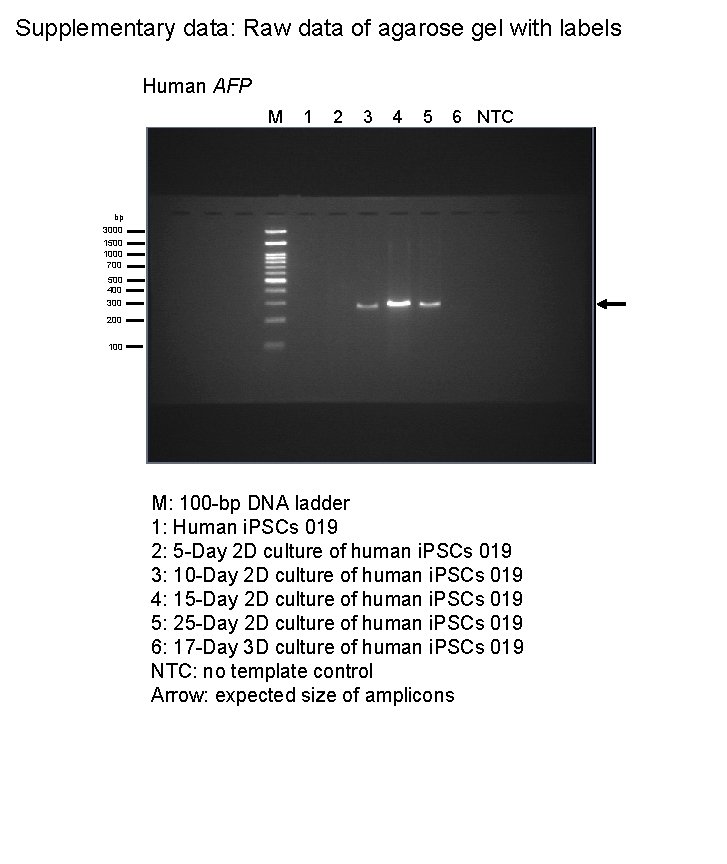 Supplementary data: Raw data of agarose gel with labels Human AFP M 1 2