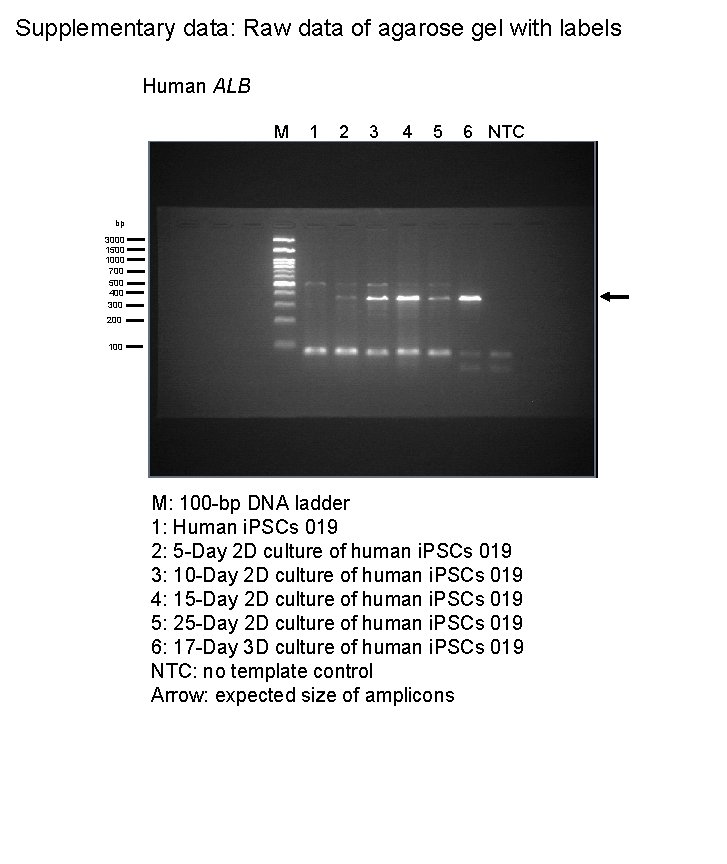 Supplementary data: Raw data of agarose gel with labels Human ALB M 1 2