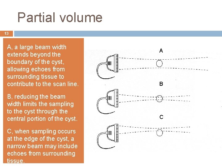 Partial volume 13 A, a large beam width extends beyond the boundary of the