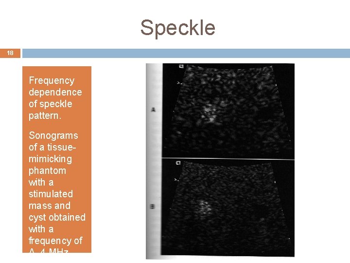 Speckle 18 Frequency dependence of speckle pattern. Sonograms of a tissuemimicking phantom with a