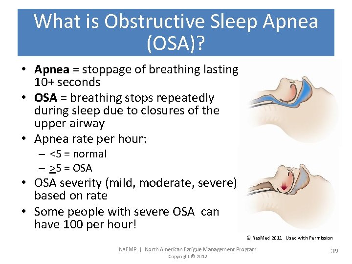 What is Obstructive Sleep Apnea (OSA)? • Apnea = stoppage of breathing lasting 10+