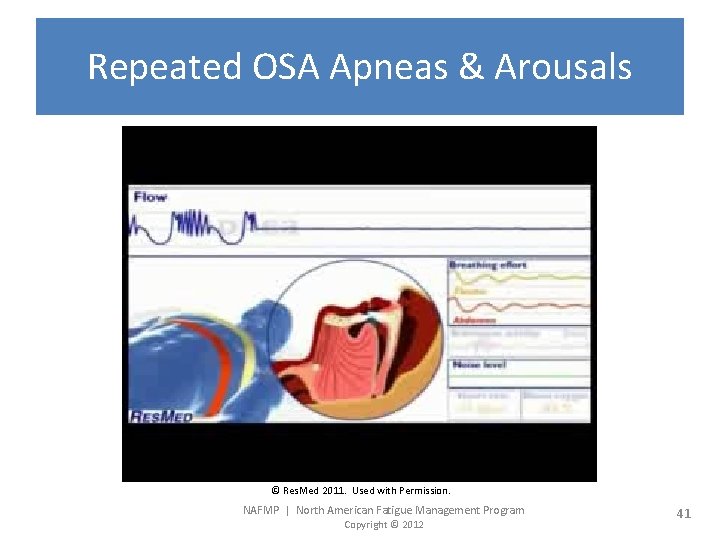 Repeated OSA Apneas & Arousals © Res. Med 2011. Used with Permission. NAFMP |