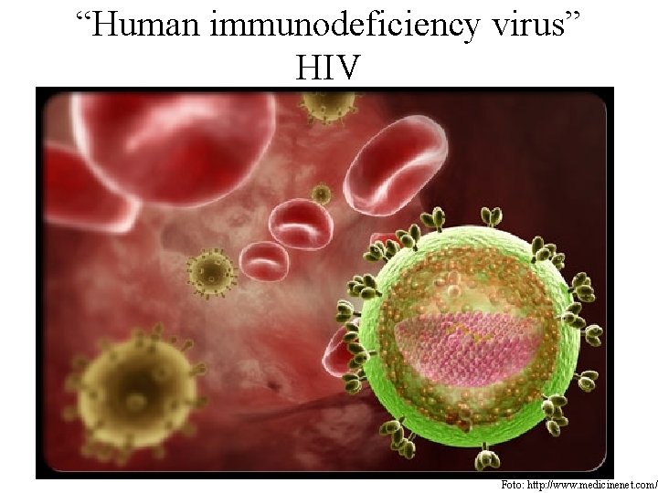 “Human immunodeficiency virus” HIV Foto: http: //www. medicinenet. com/ 