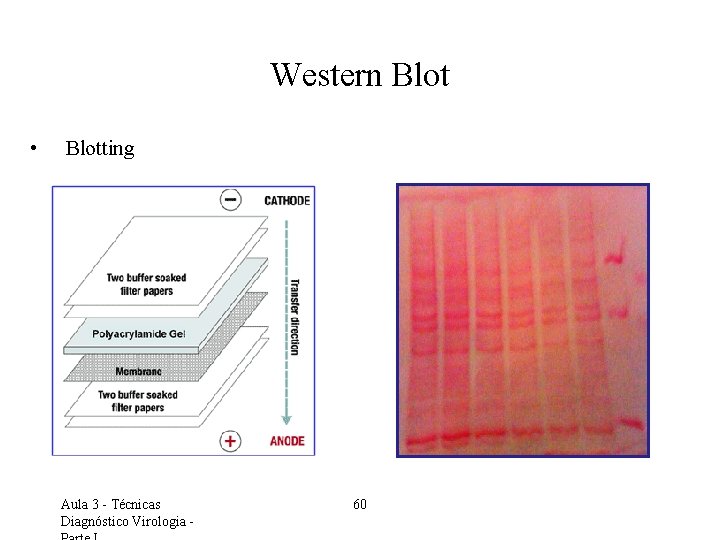 Western Blot • Blotting Aula 3 - Técnicas Diagnóstico Virologia - 60 