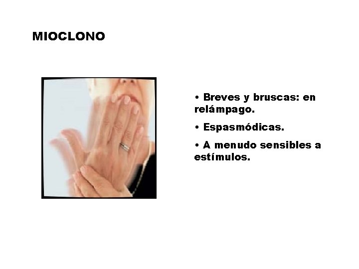 MIOCLONO • Breves y bruscas: en relámpago. • Espasmódicas. • A menudo sensibles a