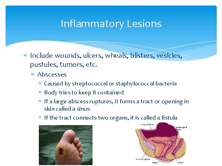 Inflammatory Lesions Include wounds, ulcers, wheals, blisters, vesicles, pustules, tumors, etc. Abscesses Caused by