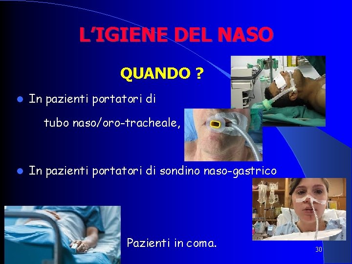L’IGIENE DEL NASO QUANDO ? In pazienti portatori di tubo naso/oro-tracheale, In pazienti portatori L’IGIENE DEL NASO QUANDO ? In pazienti portatori di tubo naso/oro-tracheale, In pazienti portatori