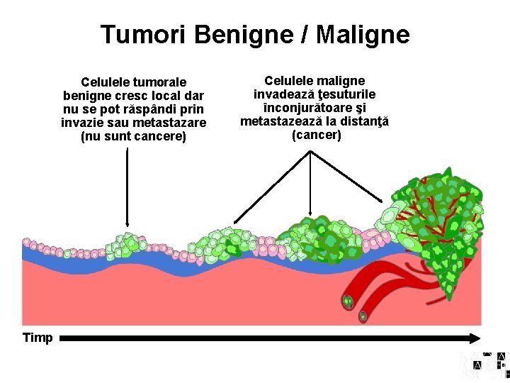 Tumori Benigne / Maligne Celulele tumorale benigne cresc local dar nu se pot răspândi
