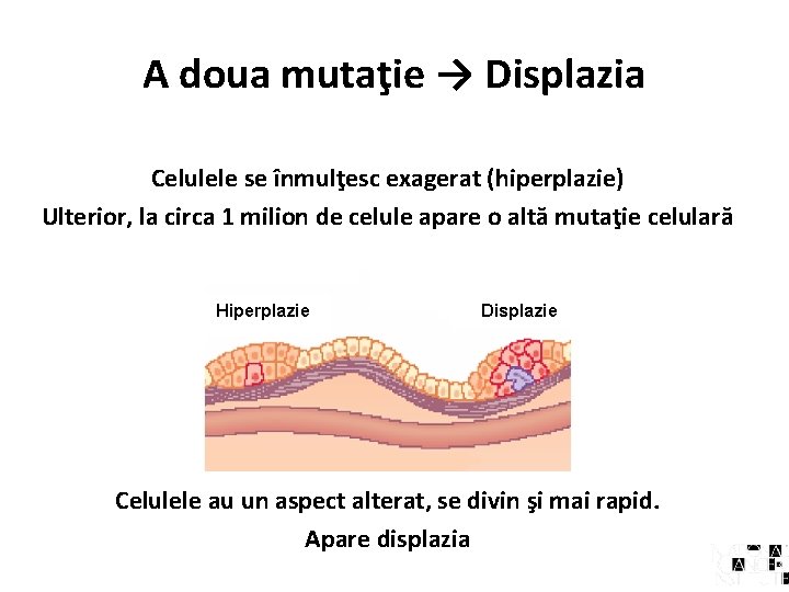 A doua mutaţie → Displazia Celulele se înmulţesc exagerat (hiperplazie) Ulterior, la circa 1