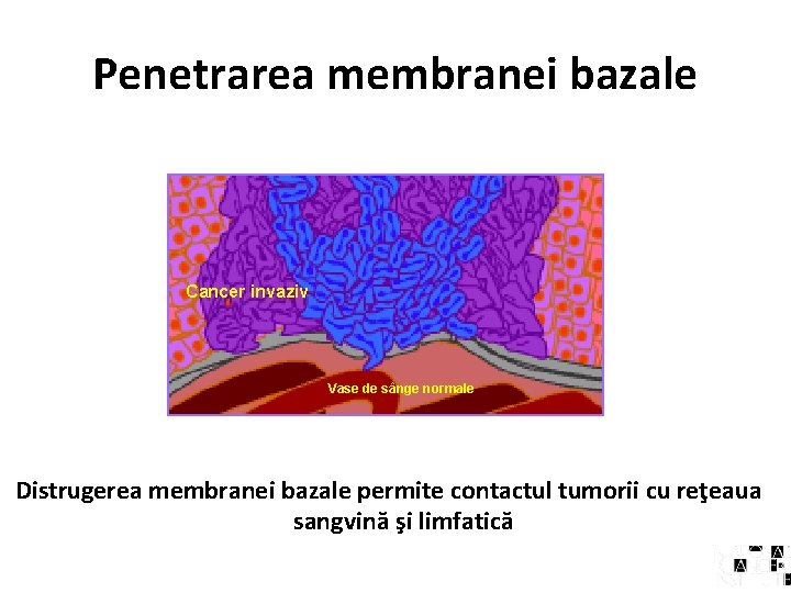 Penetrarea membranei bazale Cancer invaziv Vase de sânge normale Distrugerea membranei bazale permite contactul