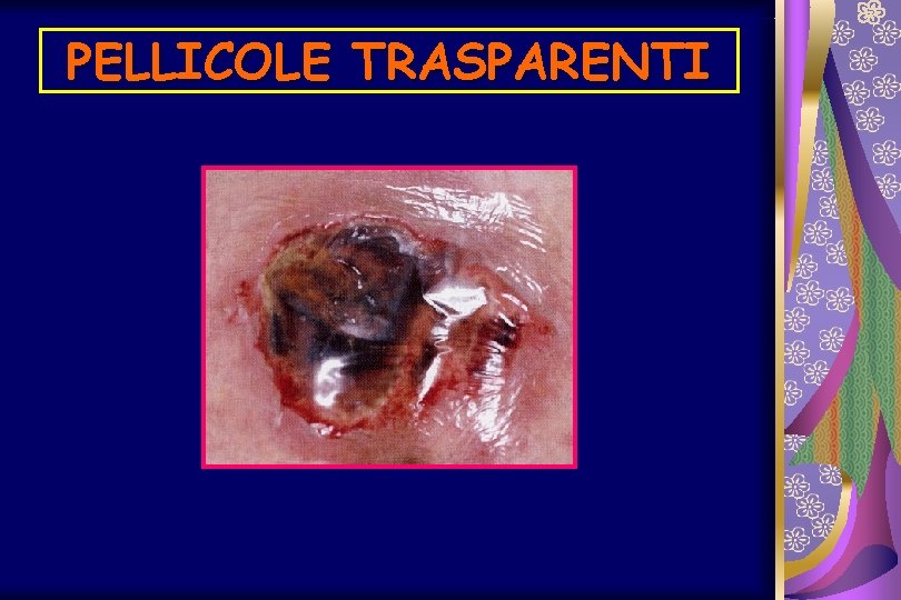 PELLICOLE TRASPARENTI 
