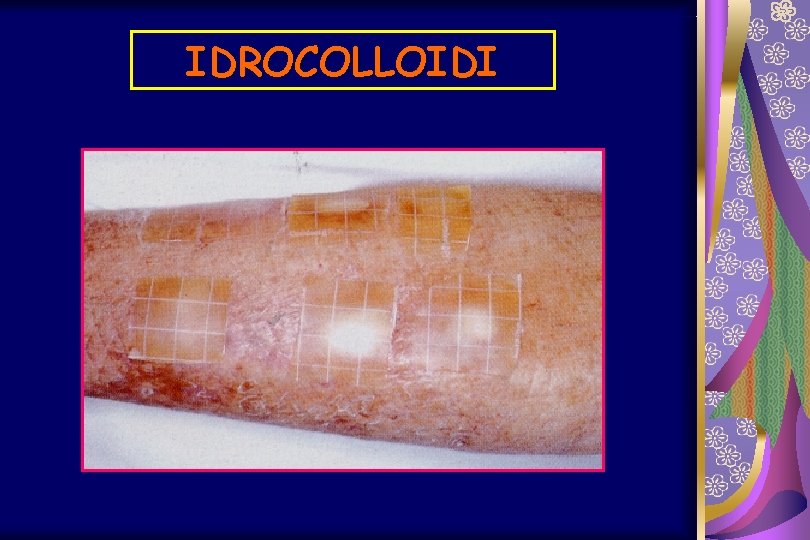 IDROCOLLOIDI 