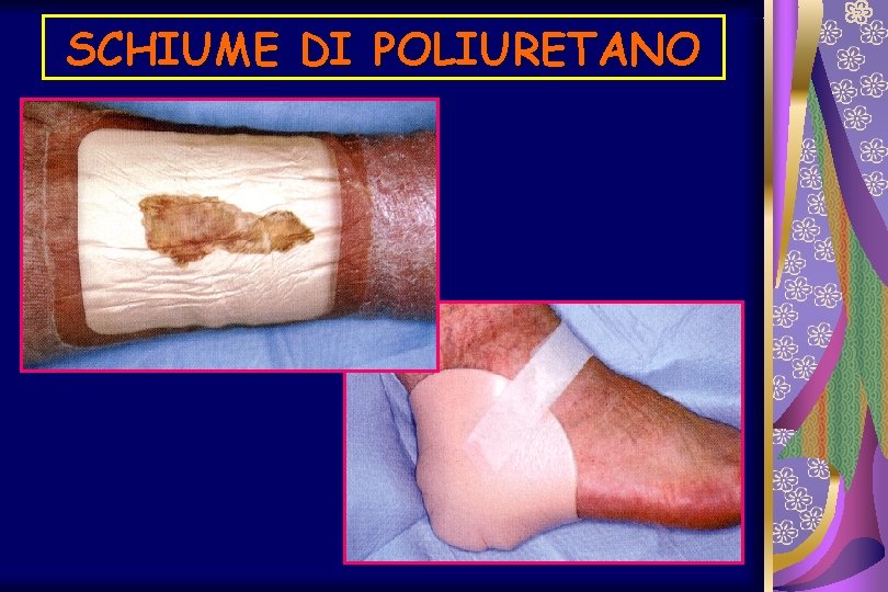 SCHIUME DI POLIURETANO 