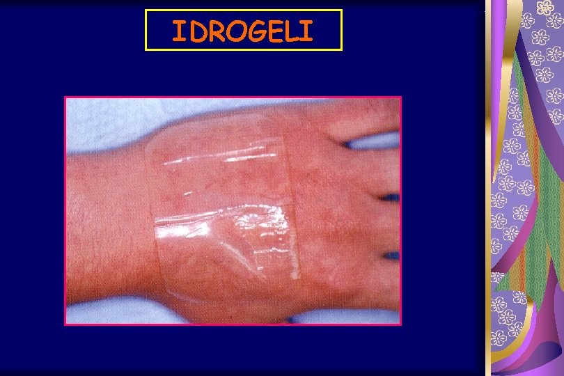 IDROGELI 