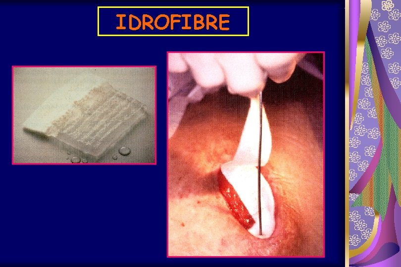 IDROFIBRE 
