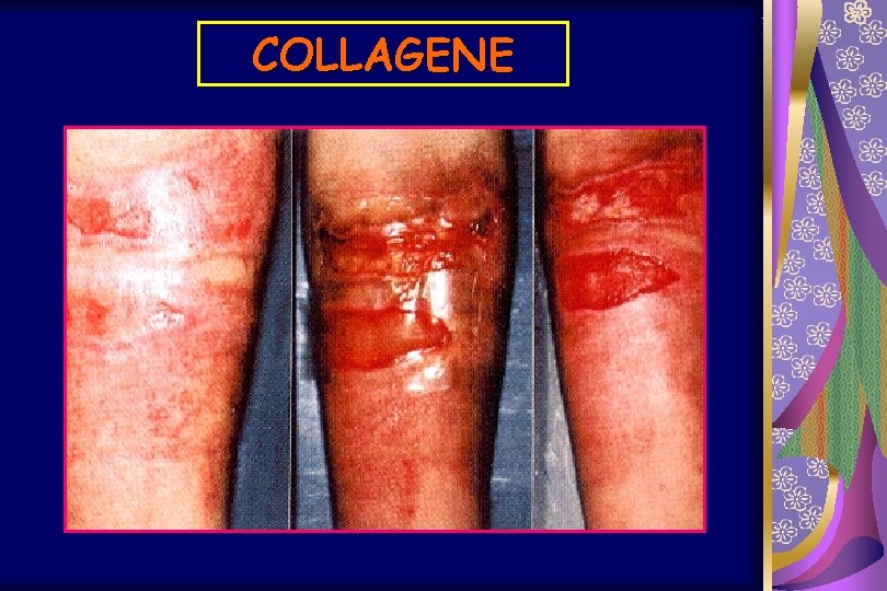 COLLAGENE 