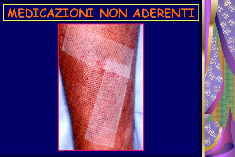 MEDICAZIONI NON ADERENTI 