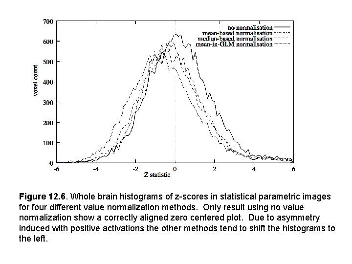 Figure 12. 6. Whole brain histograms of z-scores in statistical parametric images for four