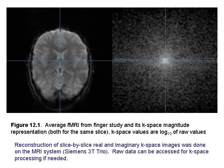 Figure 12. 1. Average f. MRI from finger study and its k-space magnitude representation