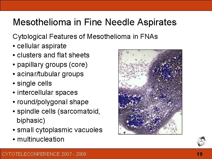 mesothelioma vegan diet