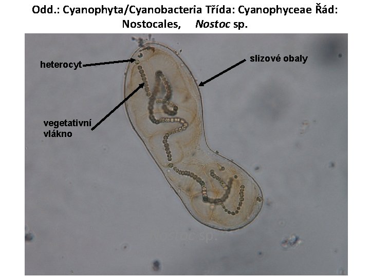 Odd. : Cyanophyta/Cyanobacteria Třída: Cyanophyceae Řád: Nostocales, Nostoc sp. slizové obaly heterocyt vegetativní vlákno