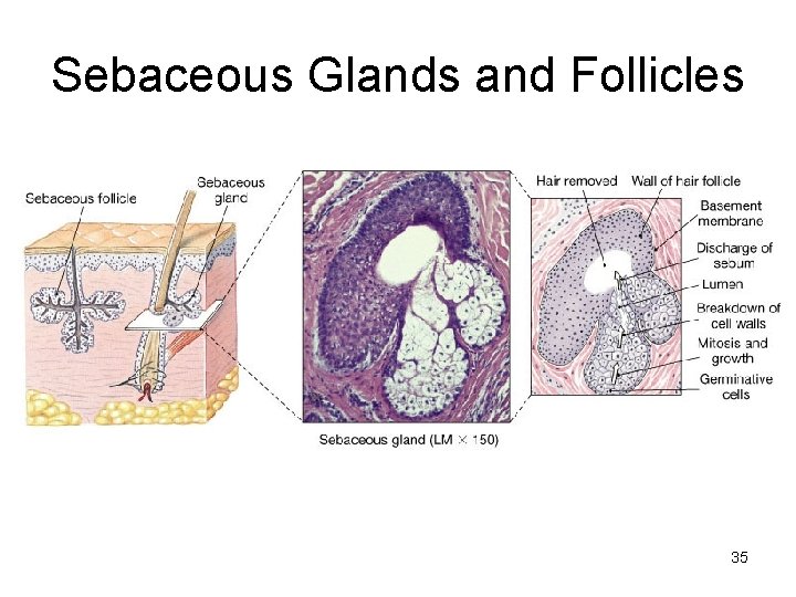 Sebaceous Glands and Follicles 35 Sebaceous Glands and Follicles 35