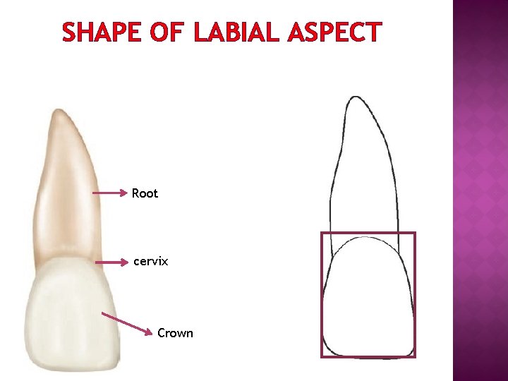 SHAPE OF LABIAL ASPECT Root cervix Crown 