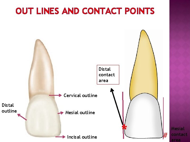 OUT LINES AND CONTACT POINTS Distal contact area Cervical outline Distal outline Mesial outline