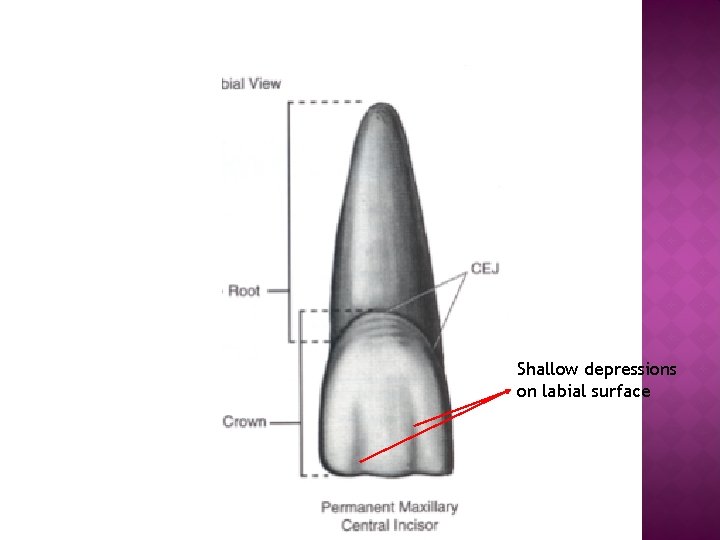 Shallow depressions on labial surface 