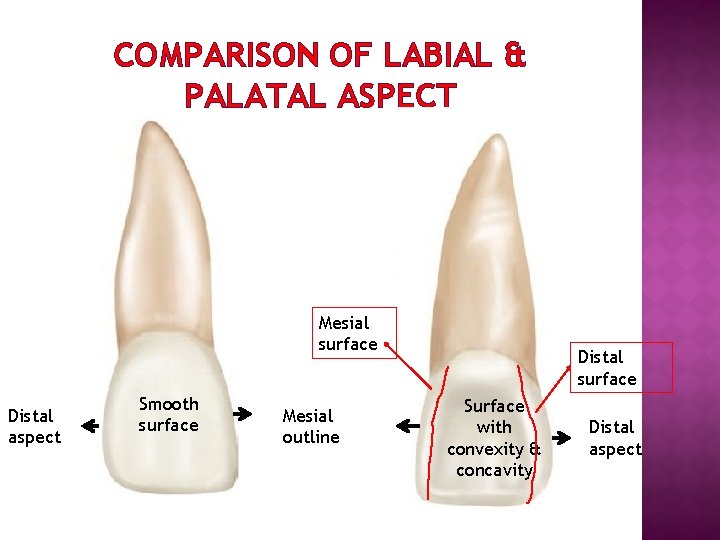 COMPARISON OF LABIAL & PALATAL ASPECT Mesial surface Distal aspect Smooth surface Mesial outline