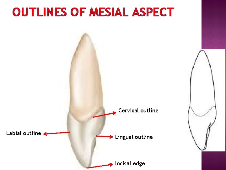 OUTLINES OF MESIAL ASPECT Cervical outline Labial outline Lingual outline Incisal edge 