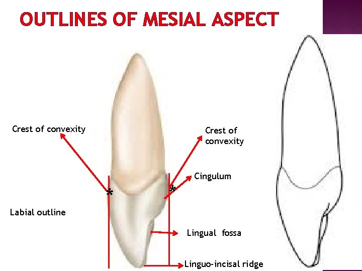 OUTLINES OF MESIAL ASPECT Crest of convexity Labial outline Crest of convexity * *