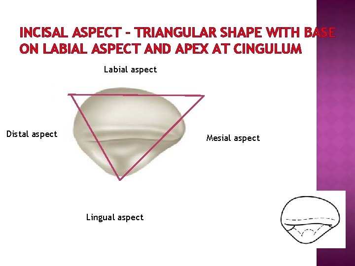INCISAL ASPECT – TRIANGULAR SHAPE WITH BASE ON LABIAL ASPECT AND APEX AT CINGULUM