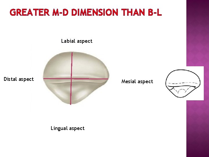 GREATER M-D DIMENSION THAN B-L Labial aspect Distal aspect Mesial aspect Lingual aspect 