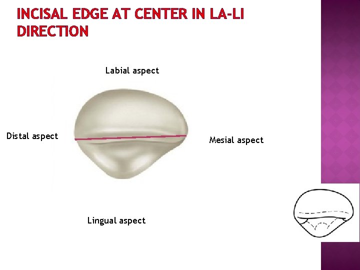 INCISAL EDGE AT CENTER IN LA-LI DIRECTION Labial aspect Distal aspect Mesial aspect Lingual