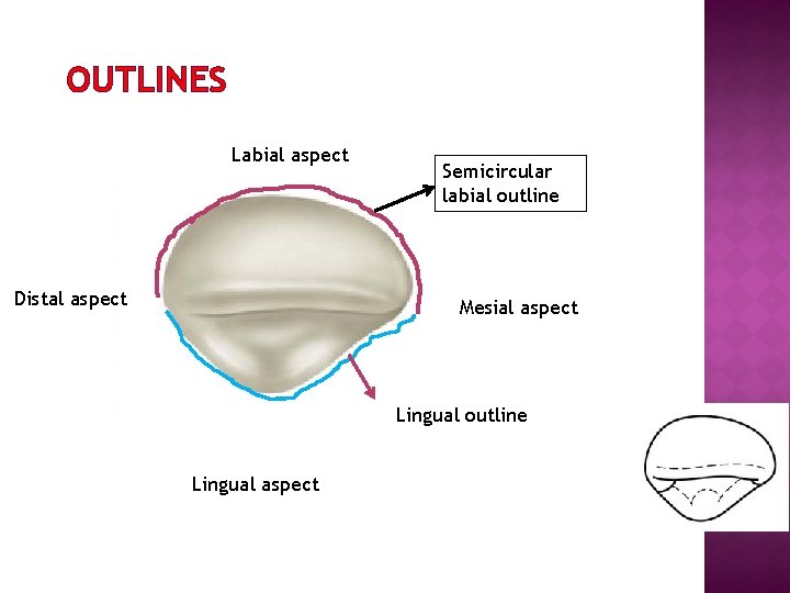 OUTLINES Labial aspect Distal aspect Semicircular labial outline Mesial aspect Lingual outline Lingual aspect