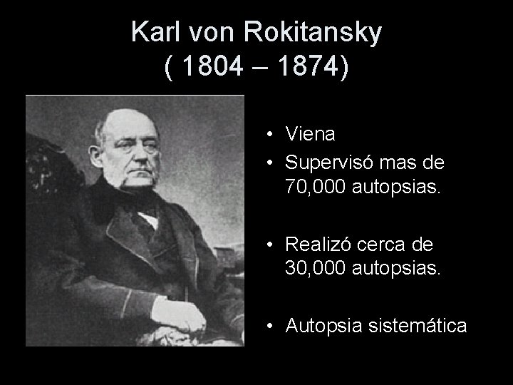 Karl von Rokitansky ( 1804 – 1874) • Viena • Supervisó mas de 70,